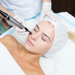 Formation Microneedling